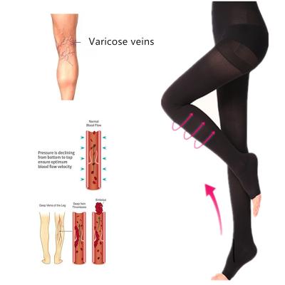 China For Varicose Professional Medical Grade 23-32 mmHg Pantyhose Compression Socks For Varicose Veins Medical Stocking for sale