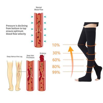 China For Varicose Professional Medical Grade 23-32 mmHg High Toe Open Thigh Compression Socks For Varicose Veins for sale