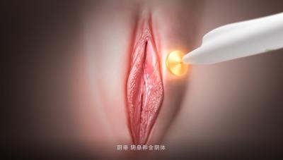 China Female RF Vaginal Rejuvenation Thermage Vulva Rejuvenation Laser Urinary Incontinence for sale