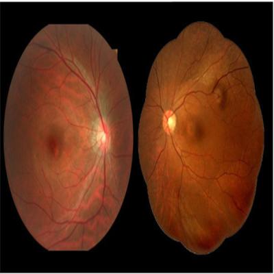 China Niet Mydriatic Digitale Fundus Camera 5 de Wijzen Multifunctionele Software van de Beeldaanwinst Te koop