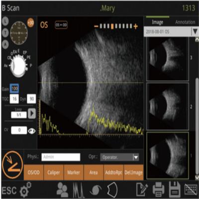 China Fórmulas múltiples del cálculo Digital del software inteligente IOL de Mini Ultrasound Scanner Machine With en venta