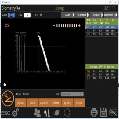 Κίνα Μηχανή 10MHz ανίχνευσης ανίχνευσης Β ανεμιστήρων που παρατηρεί την αμφιβληστροειδική αποσύνδεση προς πώληση