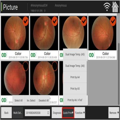 China Hand Digitale Fundus de Coherentietomografie van de Cameraoftalmologie Te koop