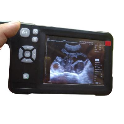 Κίνα Four-Color Portable Cattle Ultrasound Scanner Livestock Pregnancy Testing Machine Ultrasound Scanner PIG B Detector Portable Pseudocolor προς πώληση