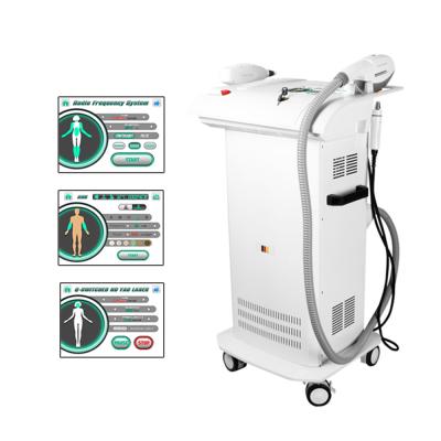 China 3000W Ipl indolor pigmentam o equipamento da beleza da remoção Ipl+rf à venda