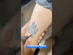 picosecond laser for tattoo removal #laserclinic #lasertreatment #beautymachine #factorydirect #skin