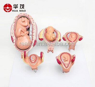 China HM-BD-169 fetal development Embryonic fetal growth model model Fetal development model HM-BD-169 model 5parts for sale