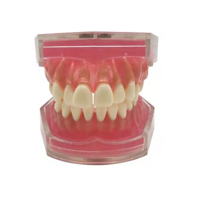 China Education Standard Model Teaching Denture Model Student Doctors Practice Tooth Dental Extraction Model for sale