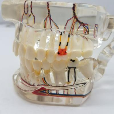 China School Hospital Adult Dental Pathology With Transparent Nerve Teeth Model Dental Teaching Tooth Model for sale