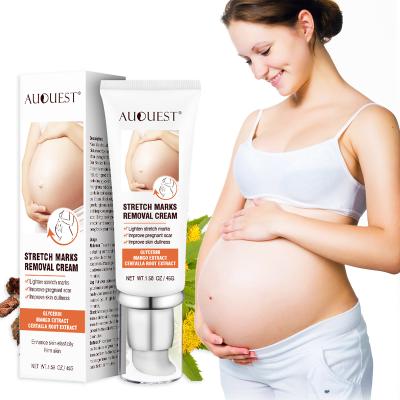 China Pregnancy Acne Private Label Skin Revitalizer Anti Leg Scar Removal Organic Herbal Deep Gel Stretch Mark Removal Repair Cream for sale