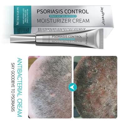 China Eczematoid Psoriasis Rash Urticaria Peeling Eczema Ointment Dermatitis Moisturizer Skin Care Psoriasis Cream for sale