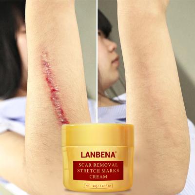 China Acne Treatment Best Selling Lanbena Stretch Mark Acne Scar Removal Cream For Skin Repair Stock 40g for sale