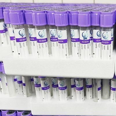 China Purple Cap Vacuum EDTA Blood Collection Tube K3 EDTA 3.2mg/ml Plastic Test Tube for sale