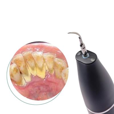 China For Home Use Factory Price Electric Tooth Cleaner Household Sonic Dental Calculus Plaque Remover for sale