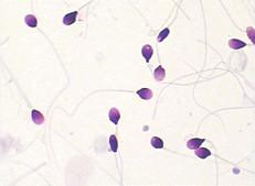 China Morphologie der Samenzellen-BRED-015, die Kit Diff Quik Rapid Staining-Methode befleckt zu verkaufen