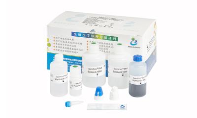 China Kit de teste de DNA de esperma SCD para determinação do nível de fragmentação de DNA em espermatozóides à venda