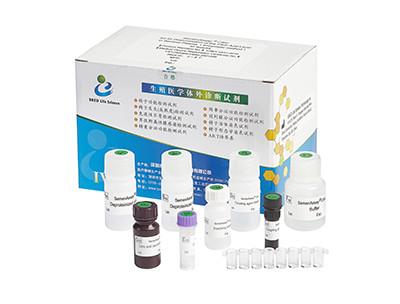 China Equipo masculino 40T/Kit de la prueba de la fertilidad de la alta exactitud para la diagnosis masculina de la infertilidad en venta