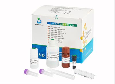 China Acrosin Kit Male Infertility Test, Spermcheck-Ergiebigkeit Kit For Men zu verkaufen