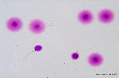 China BRED Spermien-DNA-Fragmentierungstest 24 Monate Haltbarkeit zu verkaufen