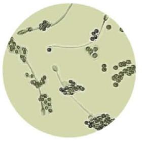 Chine Anti kit d'essai d'IgG d'anticorps de sperme MARS AsAb pour la stérilité immunologique à vendre