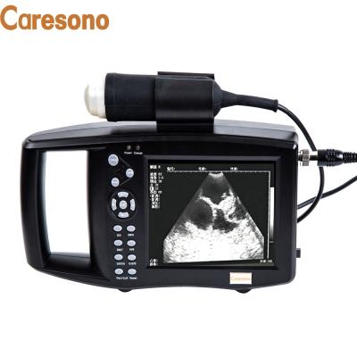 China Distance China Caresono HD 9200A ultrasonido portatil scanner for pig sheep equipos veterinarios for sale