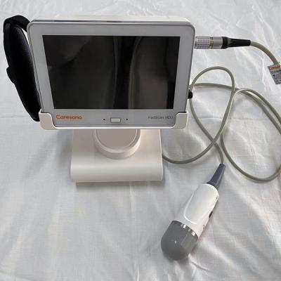 China 2018 Hot Resin China Medical Portable Bladder Scanner for sale