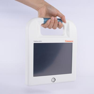 China Resin Portable Ultrasound Device For Urinary Volume Measurement Bladder Scanner Device Medical Device Manufacturer for sale