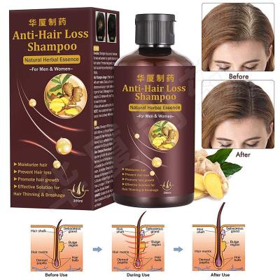 Chine Aides de shampooing d'épaississement de cheveux de shampooing de perte des cheveux de marque de distributeur arrêter la perte des cheveux à vendre