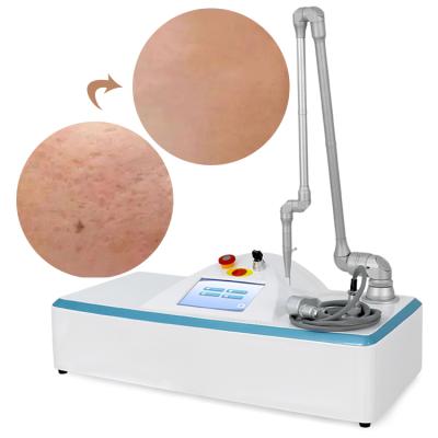 China 2022 Trend Anti-Puffiness Stretch Mark Remover Machine Vaginal Tightening Laser Machine CO2 Partial Skin Resurfacing Machine for sale