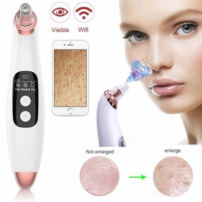 China Acne Treatment WiFi Blackhead Remover With Vacuum Suction With Electric Facial Acne Remover Electric Facial Pore Camera Nose Nose Removal Machine for sale