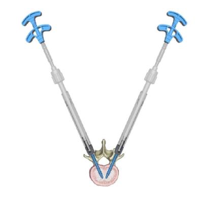 China Posterior Thoracolumbar Vertebral Augmentation Devices Screw Rod Fixation System for sale