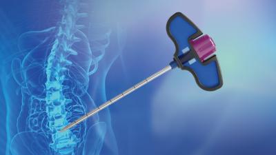 China Conjunto de agujas de vertebroplastia para el sistema de vertebroplastia curva percutánea en venta