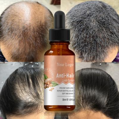 China Private Label Natural Vegan Scalp Hair Care Oil 30ml Organic Nourishing Hair Growth Serum Loss Prevention for sale