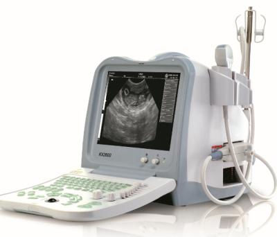 China KX2600V portable full digital B mode veterinary ultrasound scanner for sale