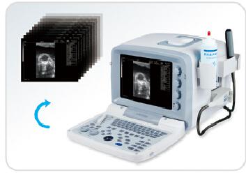 China KX2000V portable full digital B mode veterinary ultrasound scanner for sale