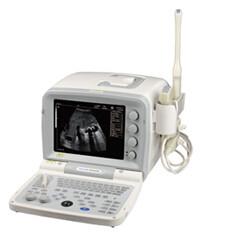 China KX2000G B/W system portable ultrasonic diagnostic instruments for sale