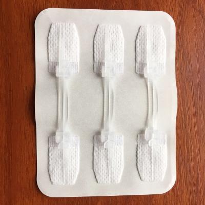 China Disposable Stitchless Zipper Wound Closure System for sale