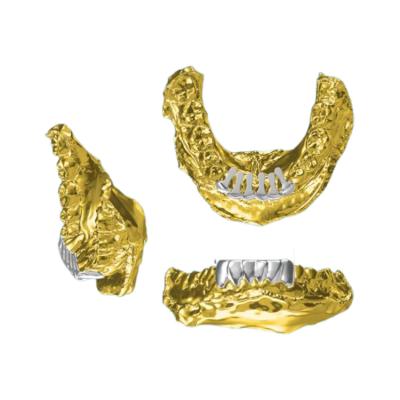 China TRENDY Custom  Design Unique Dental Grillz 18K Golden Grills Diamond Teeth Gold For Dental Jewelry for sale