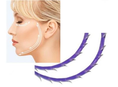 China Absorbable barbed thread Pdo Meso Lift Cog 4D 3D 6D for face lifting for sale