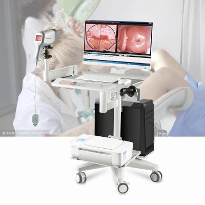 China High Resolution Core KN-2200 Colposcopy Machine Digital Video Colposcope For Gynecology Examination for sale