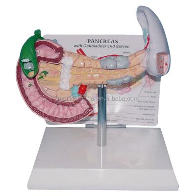 China Realistic human simulation medical gallstones and spleen and pancreas anatomical model for sale