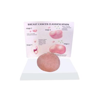 China Simulation R150104 Realistic Human Breast Cancer Self-examination Human Anatomy Teaching Model,Breast Examination Teaching Model for sale