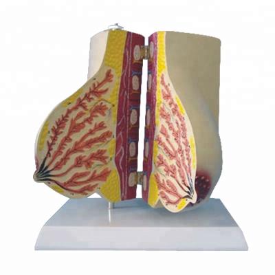 China Nursing Realistic Female Breast R150107 Human Simulation Anatomical Model, Female Reproductive Breast Models for sale