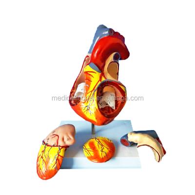 China Realistic Human Simulation 2 Parts 3 Times Life Size 3D Heart Model Organs Education for sale