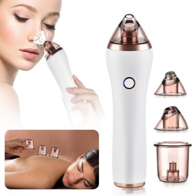 China Acne Treatment Beauty Product 4 in 1 Blackhead Remover Vacuum Blackhead Remover Pore Cleansing Vacuum for sale