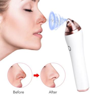 China Acne Treatment Blackhead Remover Skin Care Pore Vacuum Acne Pimple Pimple Removal Vacuum Suction Tool for sale