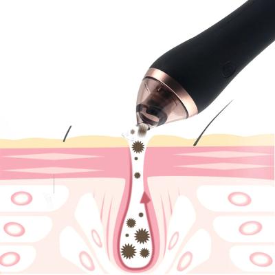 China 2021 Acne Treatment Facial Vacuum Pore Blackhead Vacuum Blackhead Vacuum Kit Diamond Microdermabrasion Machine for sale