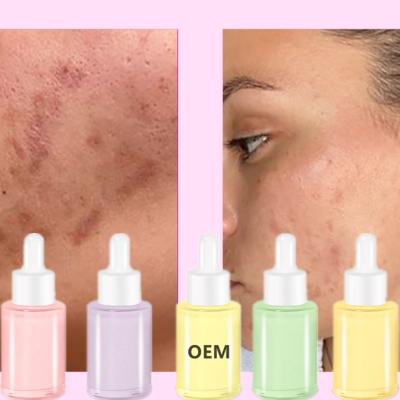 China Natural Facial Organic Whitening Face Skin Care Serum Fruit Extract Lacto Serum Essence Korean Cosmetics Moisturizer Skin Care for sale