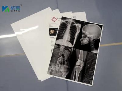 Cina 13X17'' White 180 Microns PET X Ray Film Sheets Transparency Film For Inkjet Printers in vendita