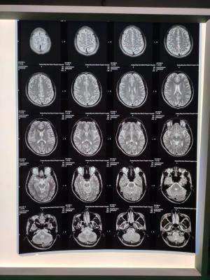 China 210 Microns Inkjet X Ray Film A3 for sale